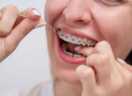 Diş Teli Tedavisi Nedir?