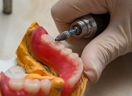 Diş Törpüleme Nedir?