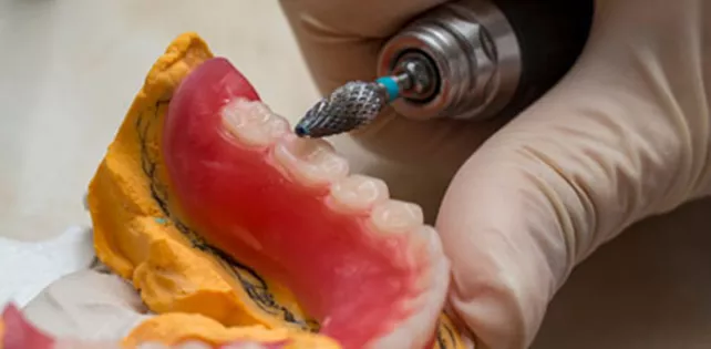 Diş Törpüleme Nedir?